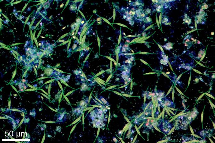 Von Bakterien und Mikroalgen auf einer Plastikoberfläche in Wasser aus der Kieler Förde gebildeter Biofilm. Die Aufnahme wurde mit Konfokaler Laserrastermikroskopie angefertigt. Von Bakterien und Mikroalgen auf einer Plastikoberfläche in Wasser aus der Kieler Förde gebildeter Biofilm. Die Aufnahme wurde mit Konfokaler Laserrastermikroskopie angefertigt.