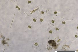 Nordsee-Plankton unter dem Mikroskop 